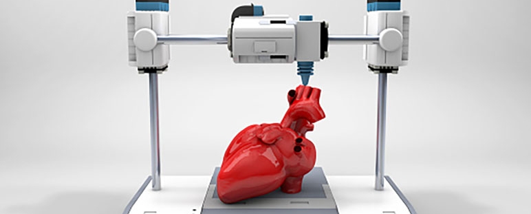 VIDA (Ventrículo Izquierdo Definitivo Artificial) 