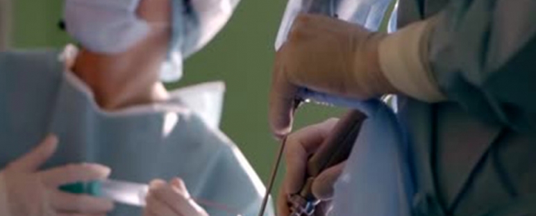 Stent-band, dispositivo endoscópico