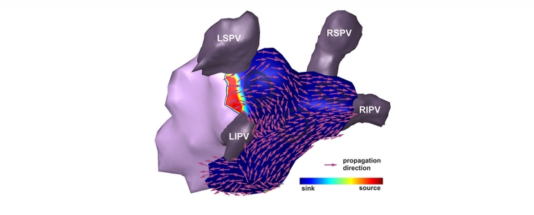 CORIFY: Dispositivo para localización de arritmias – II Premio 2016