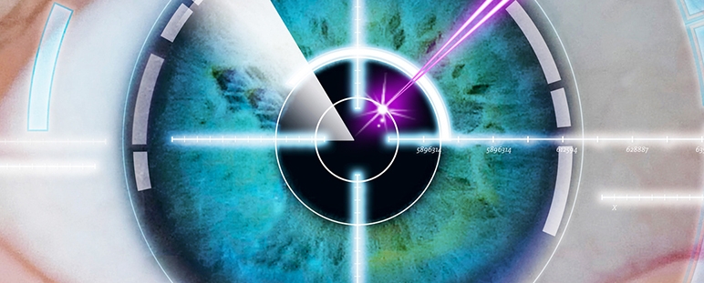 Lente intraocular acomodativa fijada con luz.