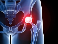 VGF (Valoración Geriátrica Funcional-App)