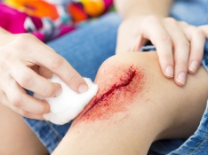 Sistemas de desinfección de grandes heridas