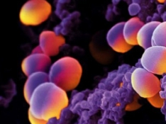 Nuevo método de detección de procesos infecciosos mediante imagen nuclear. 